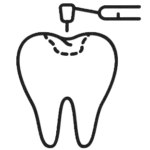 Icon - Fillings and Sealants