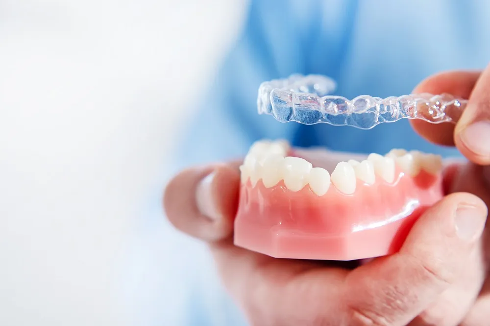 Invisalign Braces2