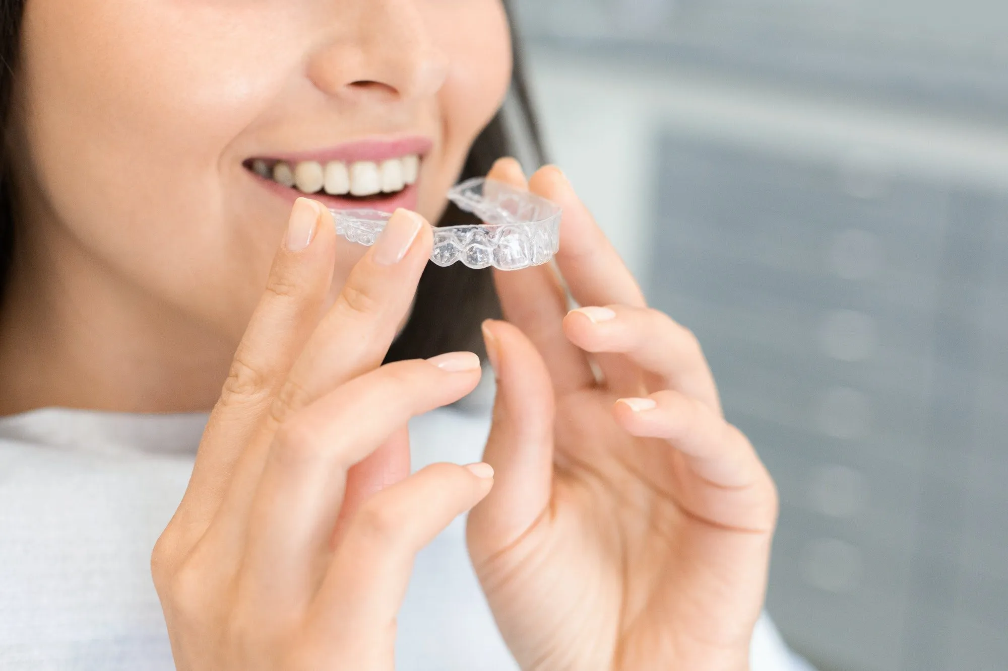 Aligners And Invisalign 1 girl-holding-invisible-braces-moder-teeth-trainer.webp
