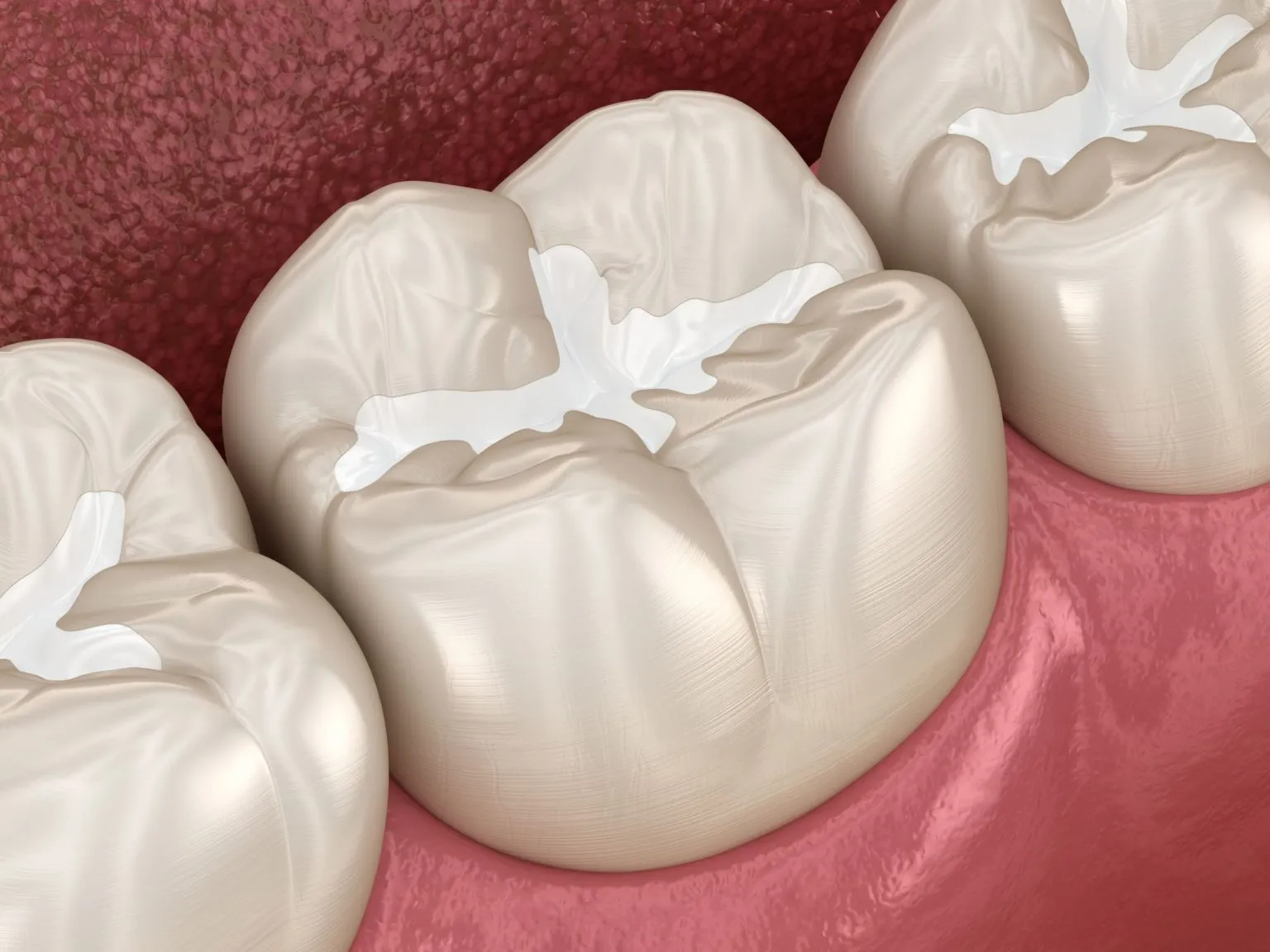 sealants 1536x1152 1